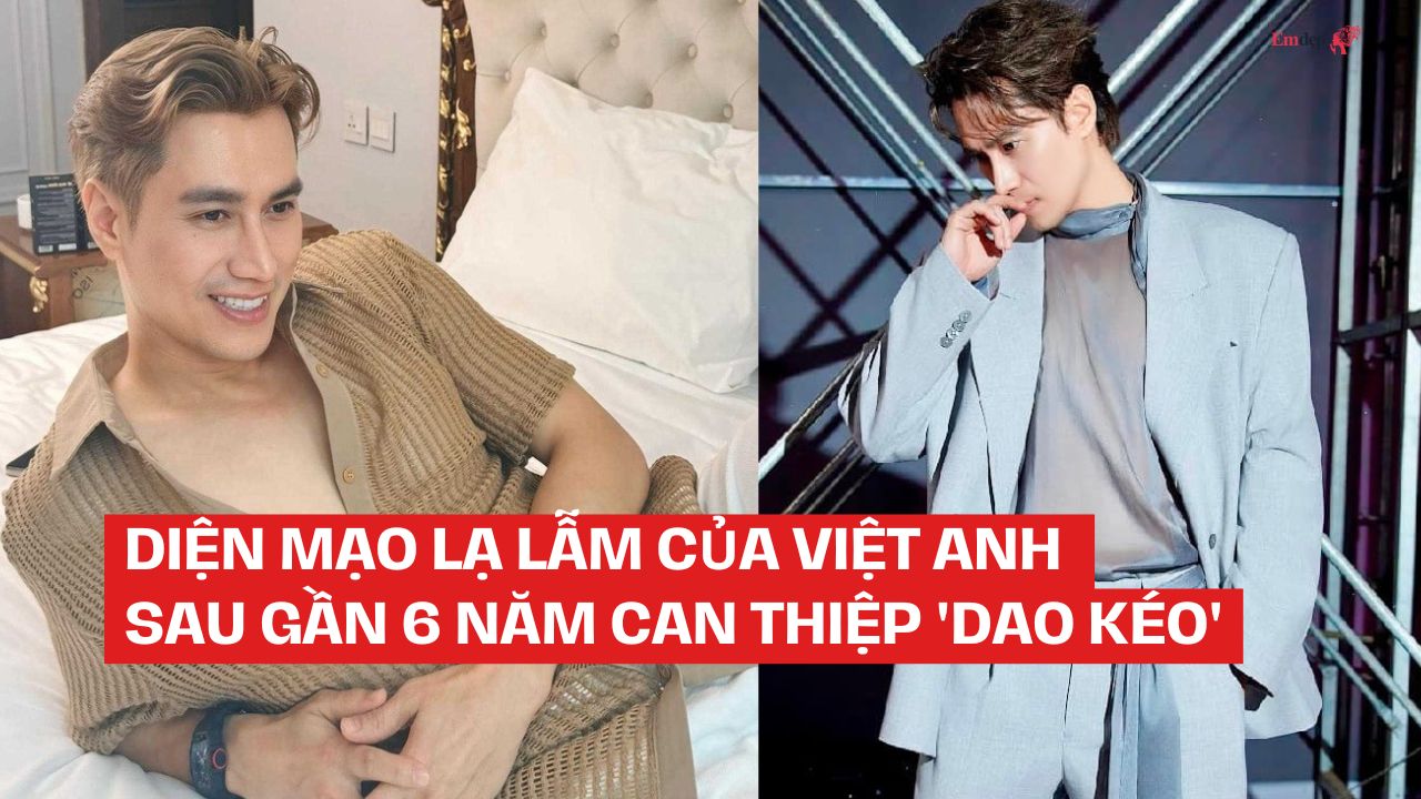 Diện mạo lạ lẫm của Việt Anh sau gần 6 năm can thiệp 'dao kéo'