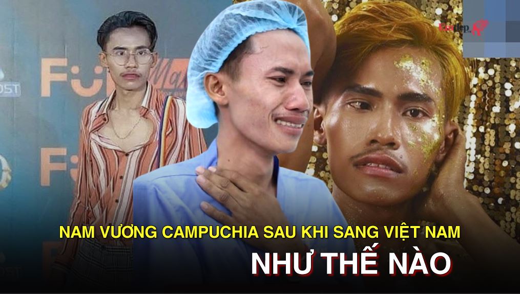 Diện mạo bất ngờ của thí sinh hot nhất Nam vương Campuchia sau khi sang Việt Nam 'nhờ bác sĩ can thiệp'