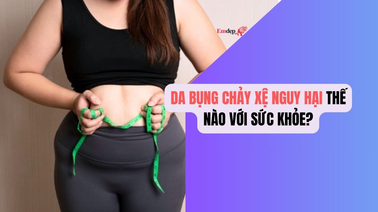 Da bụng chảy xệ nguy hại thế nào với sức khỏe?